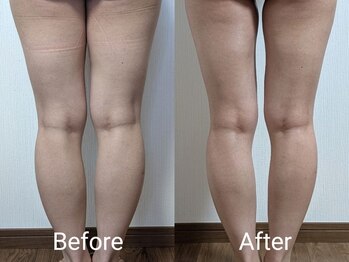 ネイル リリ(nail RiRi)/一ヶ月後