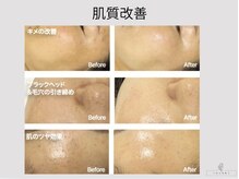 シャムリー(SHAMRY)の雰囲気（たるみケア／毛穴／ニキビ／色素沈着／シミ／美白／小顔）