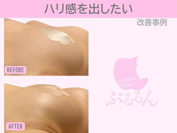 ぷるるんエステ/バストケア/バストアップ/育乳