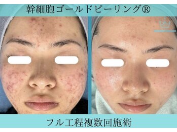 リメイク 広尾(REMAKE)/