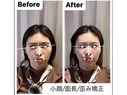 カナエル(CANAEL)の写真