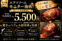 アンテグラール