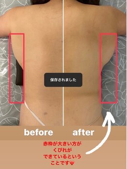 マホラ 本店(Mahora)/ブララインzero