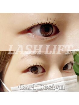 アール(R)/ラッシュリスト