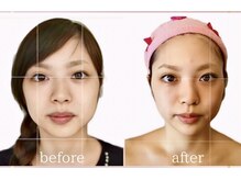 小顔美肌コルギ専門店 センティード 吉祥寺(Sentido)/印象を変える【小顔美肌コルギ】