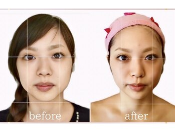 小顔美肌コルギ専門店 センティード 吉祥寺(Sentido)/印象を変える【小顔美肌コルギ】