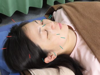 ナディ鍼灸治療院/美容鍼