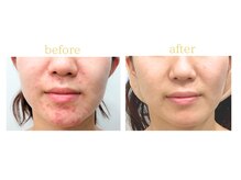 オリス 名古屋店(oliss)/リセットプログラムbefore/after