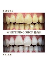 ホワイトニングショップ 葛西店/歯科提携　ホワイトニング専門店