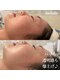 ミランサ ギンザ(MIRANSA GINZA)の写真/【夏疲れ肌に休息を！】季節の変わり目や秋の肌メンテナンスはレストセルフェイシャル¥21,780→¥14,300