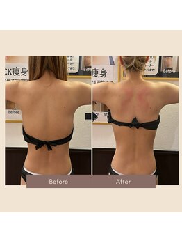 カピリナ(Kapilina)/ WINBACK60 1回【30代前半女性】