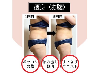 アリナ(Alina)の写真