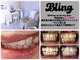 ブリング(Bling)の写真