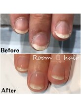ルームヘアネイル 曙橋店(Room hair nail)/ネイルケア☆ビフォーアフター