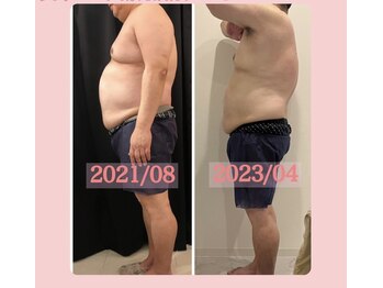 ビューティー アディクト(Beauty addict)/痩せたい方は是非ご相談下さい！