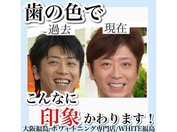 ホワイトニングサロン ホワイト(WHITE)/セルフホワイトニング/大阪/福島