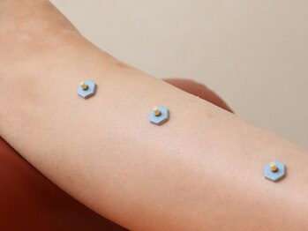 ほぐし屋百式 百式鍼灸院/お灸