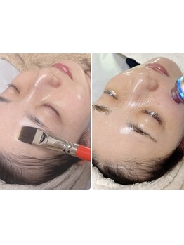 お肌をきれいにしたい