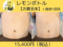 美々庵の雰囲気（寝てる間に痩身!!脂肪分解レモンボトルを注入＆EMSで引き締め!!）