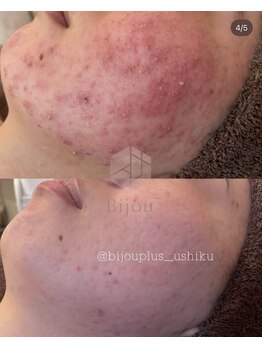 ビジュープラス ひたち野うしく店(Bijou+)/