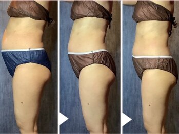 カナウ(kanau)/なりたい自分に向かって…6ヶ月