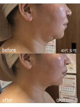 フロル(FLOR)/FLOR 【根本改善専門店】