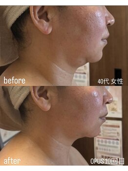 フロル(FLOR)/FLOR 【根本改善専門店】