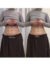 ジョワイユ(Joyeux)/腸の位置でお腹は変わる