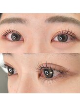 アール(R)/ラッシュリフト