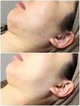 クレビア(CREBIA)/