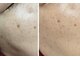 ラヴォーテ ソラ(La beaute sola)の写真/シミやたるみ毛穴をケアして肌質改善! ゆったり空間で癒しの時間をお過ごしください♪