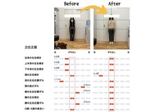 篠丸接骨院の雰囲気（施術期間1ヵ月★左右の傾きが改善されています！（AI姿勢分析））