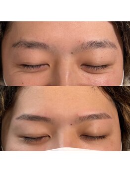 ラキー(Laki)/パラレルブロウ