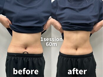 モア 札幌大通店(MORE)/ブライダル直前でもウェルカム