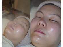 岩川治療院/スチームでしっかり保温保湿