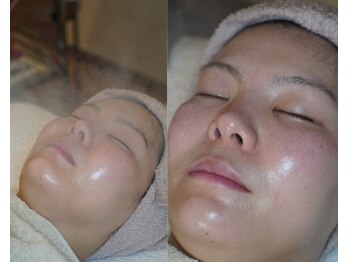 岩川治療院/スチームでしっかり保温保湿