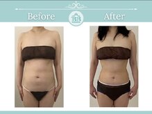 美人バスト 掛川店/【バストアップ/育乳静岡/掛川】