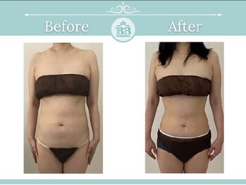 美人バスト 掛川店/【バストアップ/育乳静岡/掛川】