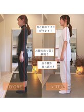 サンテリア(Santelia)/反り腰猫背姿勢矯正