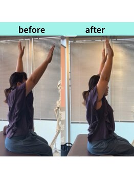 ホネツギ浦和整体院(HONETSUGI浦和整体院)/肩痛・凍結肩