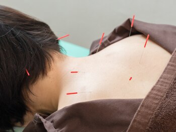 アール鍼灸整骨院