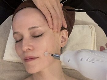 ギンザロッソ(GINZA ROSSO)の写真/最高品質エクソソームで自分至上最高の自分に♪肌のターンオーバーを促進してシミやシワを改善◇