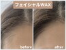 【11月限定】秋肌の衣替えしませんか？フェイシャルWAX【¥8800→¥6600】大和
