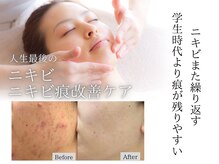 エピア 岡崎店(Epia)