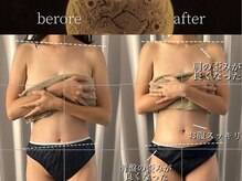 リムーン(REMOON.)/施術後の効果★