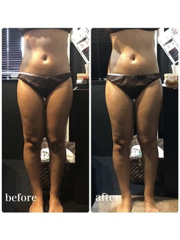 ピーラトゥ 日立(P-Ratu)/全身痩せ◎