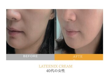 ホープリテーラー 安城店(HOPE Retailer)/施術写真