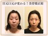 【人気No.1】スーパーたるみケア!老顔たるみ改善V字フェイスライン美骨形成術