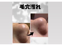 ワン(One)の雰囲気（ハイドロ毛穴洗浄で黒ずみオフ頑固な角栓を大掃除してツヤ肌に）