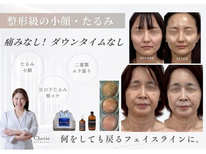 シェリー(Cherie)の写真